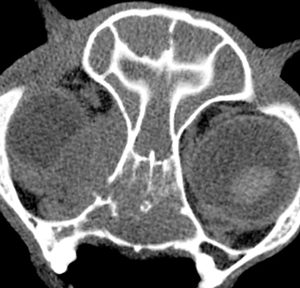 CT_study8-Orbital_mass-thmb